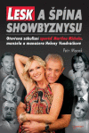 Lesk a špína showbyznysu
